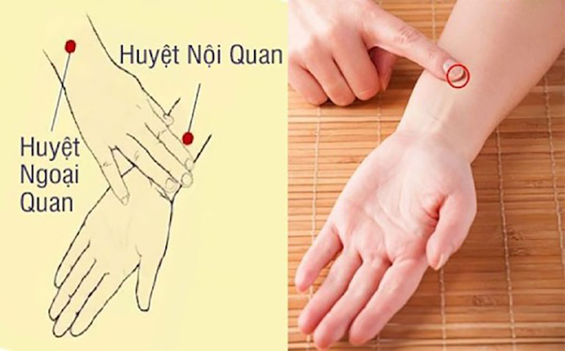 Huyệt nội quan nằm ở mặt trước của cẳng tay, nằm giữa gan cơ tay lớn và gan cơ tay nhỏ (Nguồn: Trung tâm ứng dụng Đông phương y pháp)