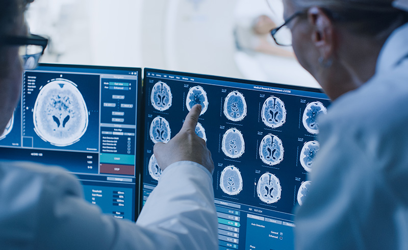 Chụp MRI não có thể giúp phát hiện bất thường trong não, chẩn đoán chính xác nguyên nhân gây đau đầu bên trái