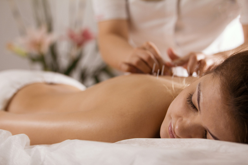 Châm cứu giúp kích thích các huyệt đạo bên trong cơ thể, giúp máu huyết lưu thông lên não tốt hơn