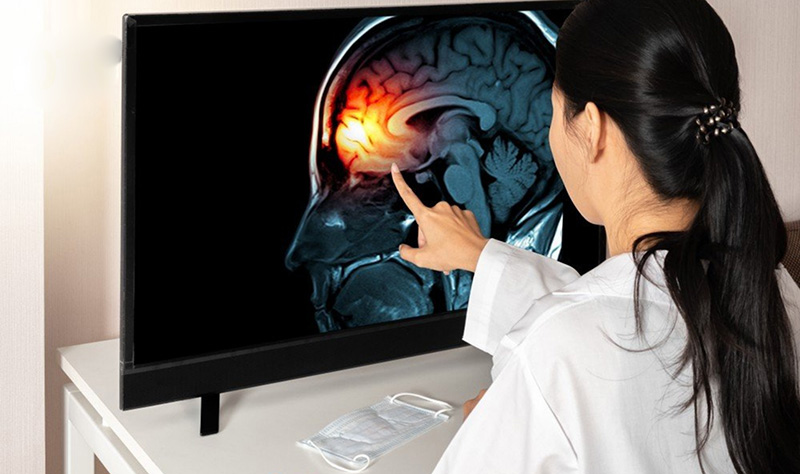 Chấn thương não được gọi là nhẹ khi người bệnh mất ý thức dưới 30 phút