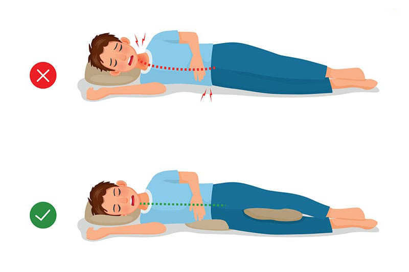 Tư thế đúng khi nằm nghiêng