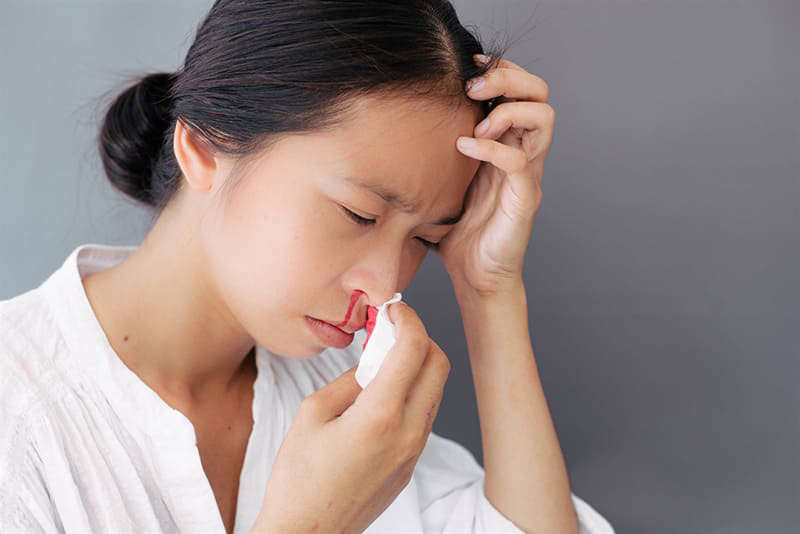 Khi bị đau đầu chảy máu cam, bạn nên ngồi dậy để hạ huyết áp trong mũi và giúp giảm chảy máu