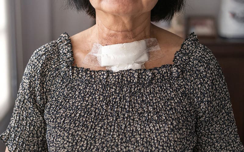 Vết mổ tuyến giáp có thể gây ra đau đớn về đêm, cản trở giấc ngủ của người bệnh.