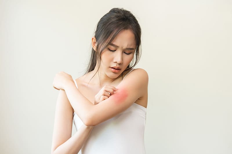nguoi co co dia di ung nen can nhac người có cơ địa dị ứng nên cân nhắc