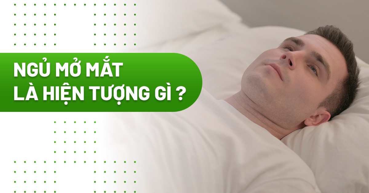 Ngủ mở mắt là gì? Nguyên nhân, dấu hiệu và cách khắc phục hiệu quả
