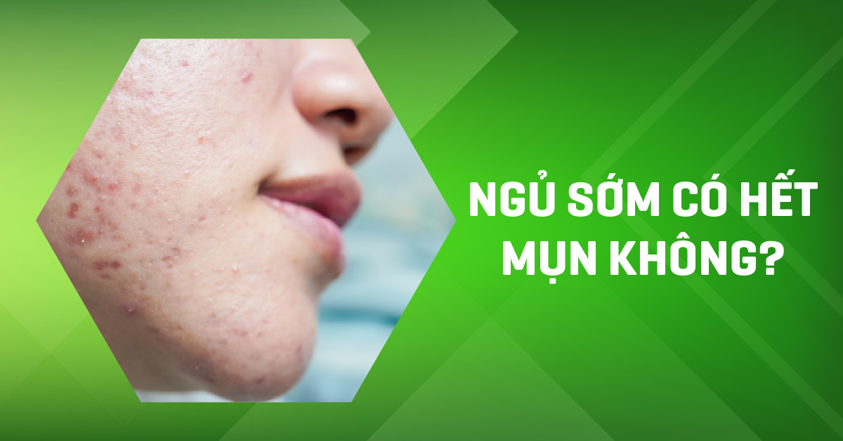 Thức khuya gây mụn vậy ngủ sớm có hết mụn không?